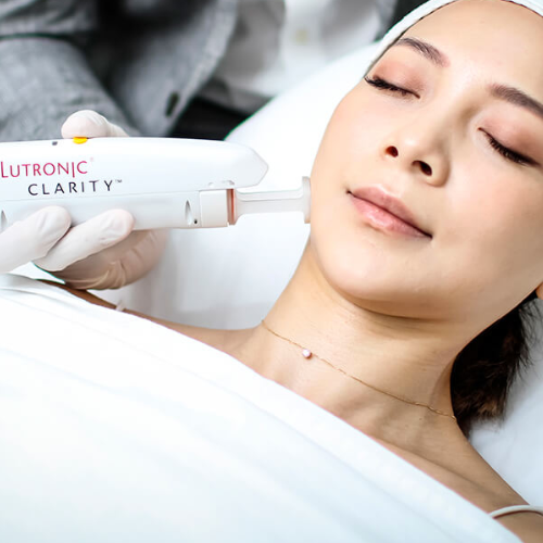 Laser Skin Resurfacing – Single Area Treatment – available at Beauty O’Clock Medical Spa in Aurora & Vaughan