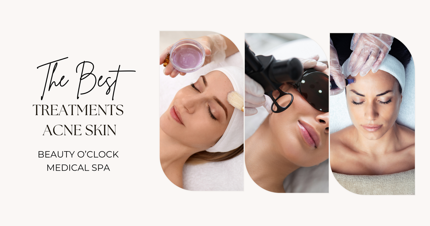 Chemical Peels, Laser Skin Resurfacing, and HydraFacial treatments available at Beauty O'Clock in Vaughan & Aurora