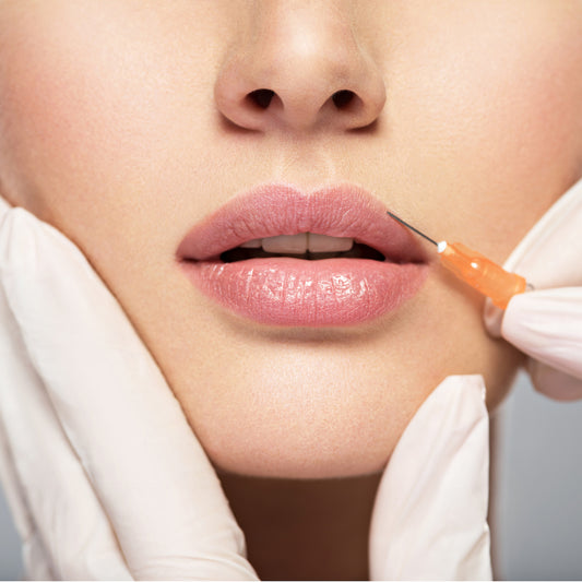Botox® Lip Flip Injection