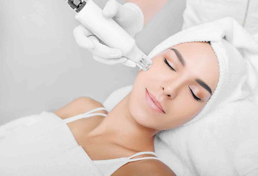 Microneedling – Face, Neck or Décolleté