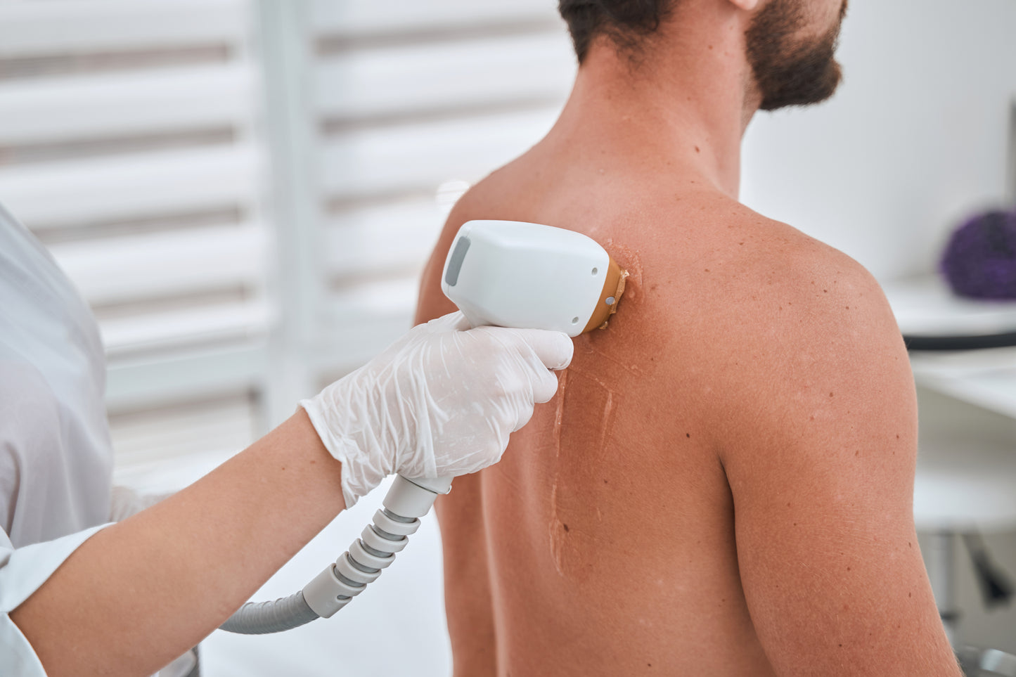 Men’s Underarms Laser Hair Removal
