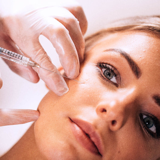 PRF - Cheek Volume Restoration – available at Beauty O’Clock Medical Spa in Aurora & Vaughan