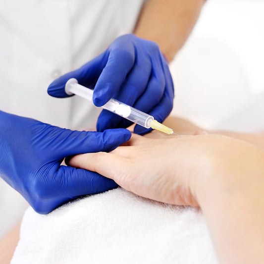 PRF - Hand Rejuvenation – available at Beauty O’Clock Medical Spa in Aurora & Vaughan