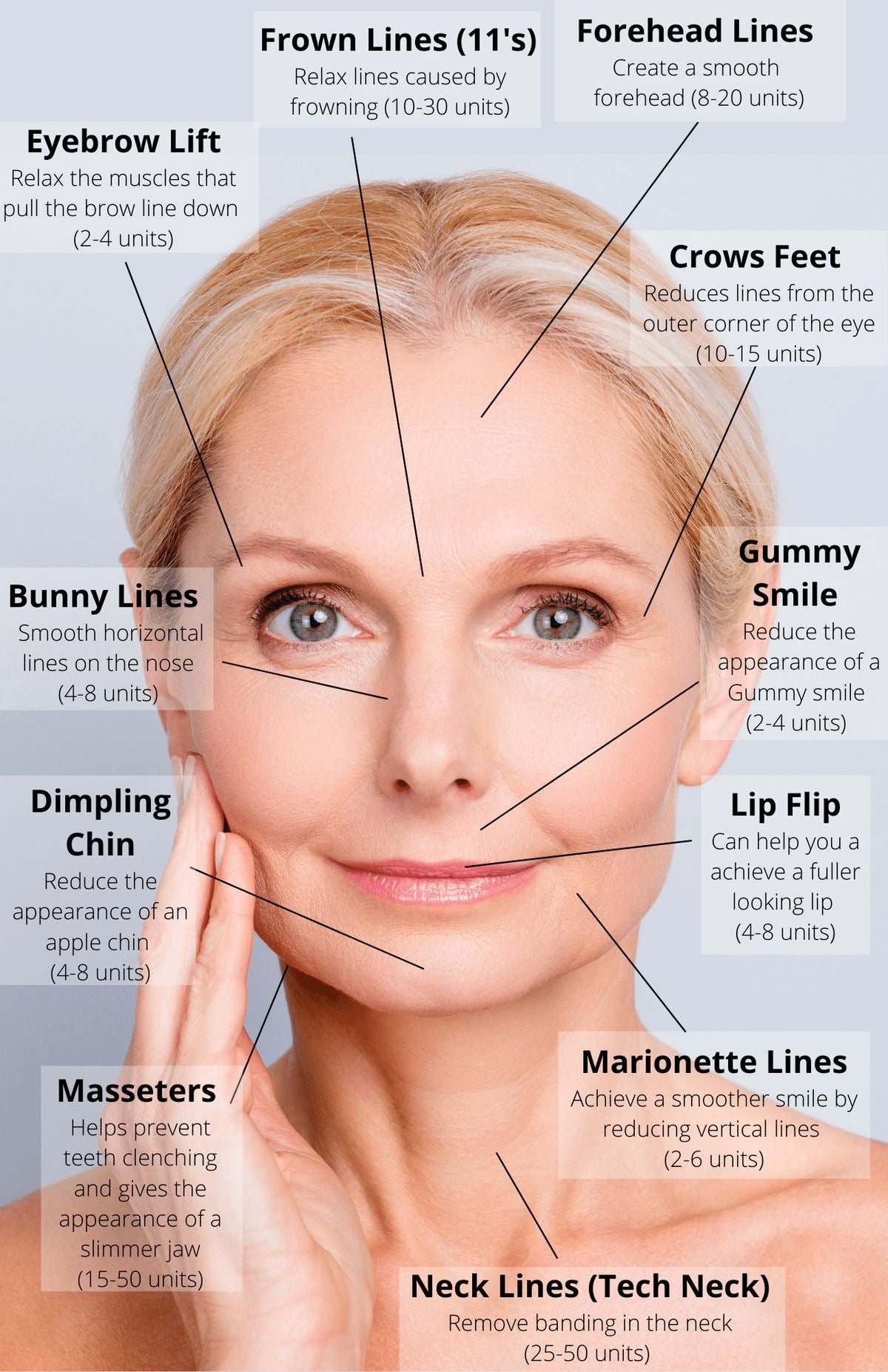Botox®/Dysport® Neurotoxin Injections