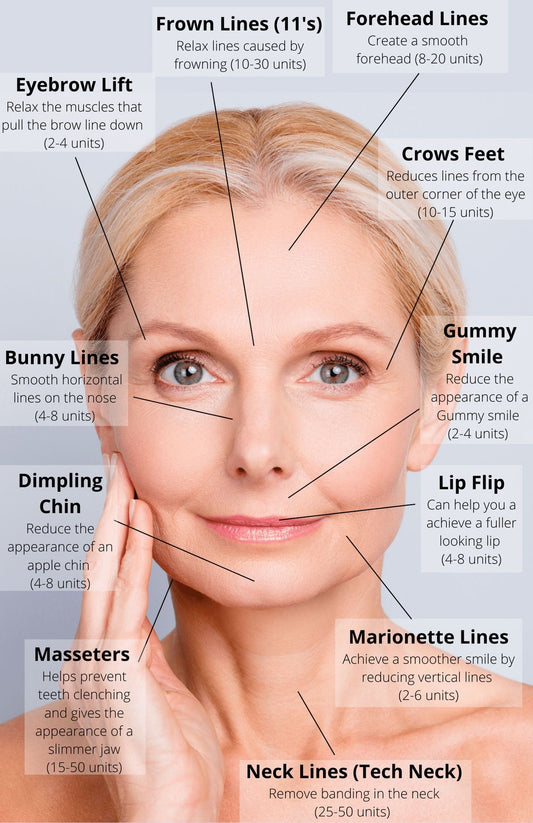 Botox® Neurotoxin Injections (100 units)
