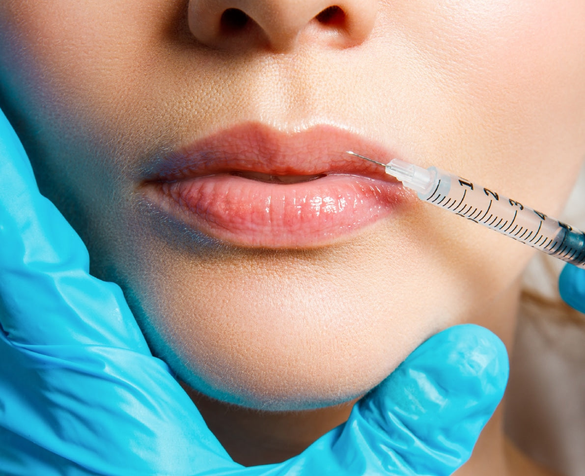 PRF - Lip Rejuvenation – available at Beauty O’Clock Medical Spa in Aurora & Vaughan