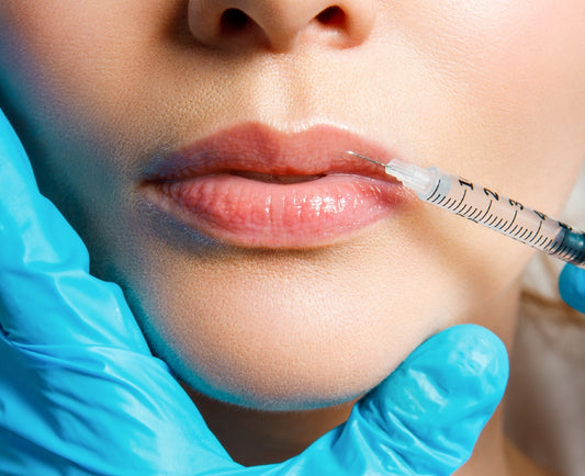 PRF - Lip Rejuvenation – available at Beauty O’Clock Medical Spa in Aurora & Vaughan