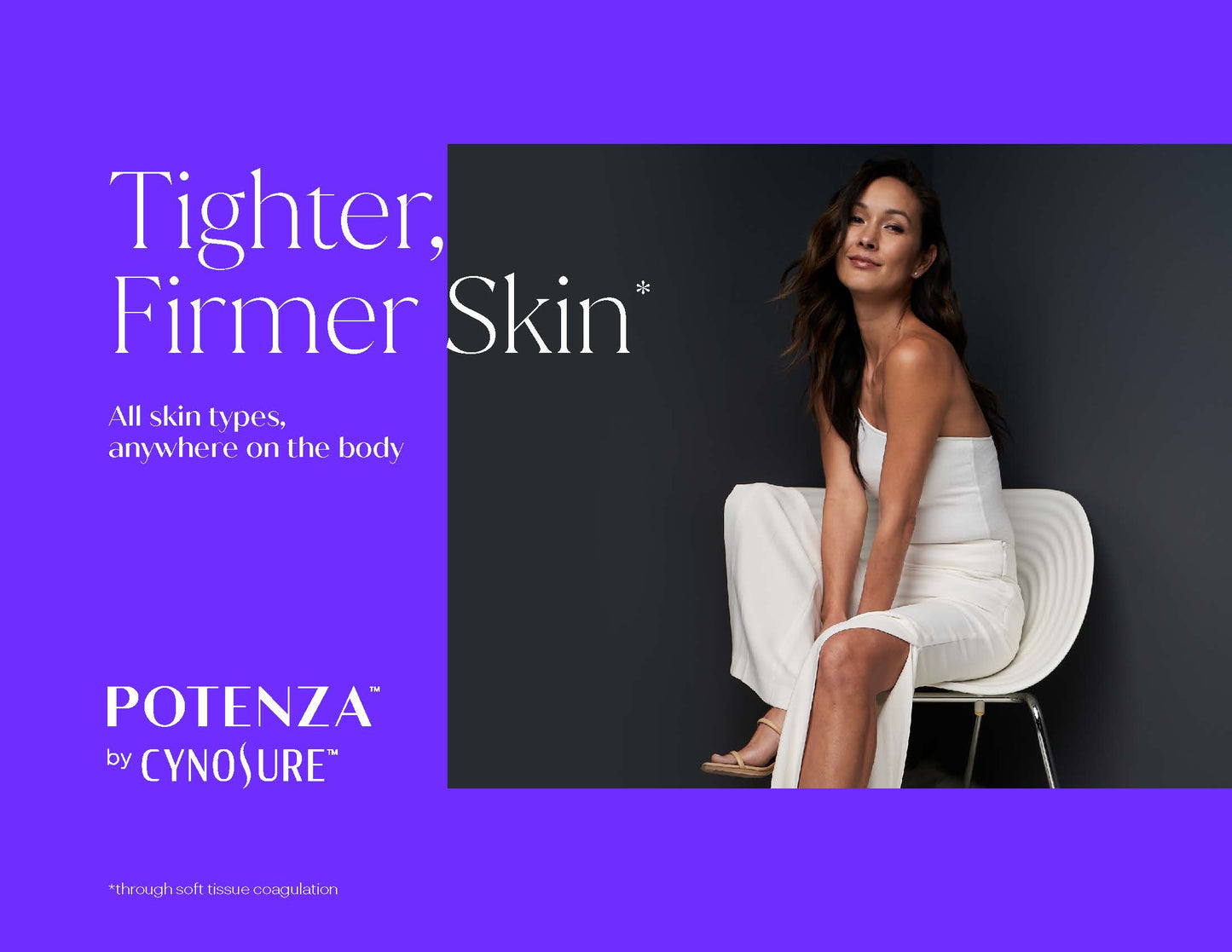 Cynosure Potenza RF – Body Treatment