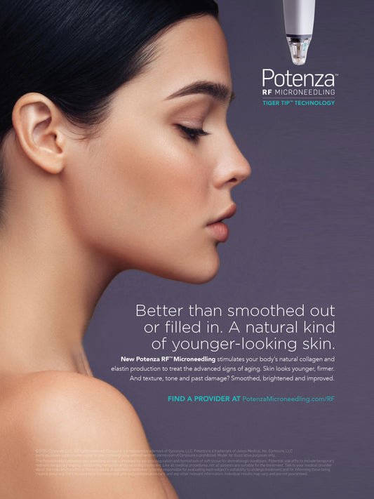 Cynosure Potenza RF – Face, Neck & Chest Treatment – available at Beauty O’Clock Medical Spa in Aurora & Vaughan