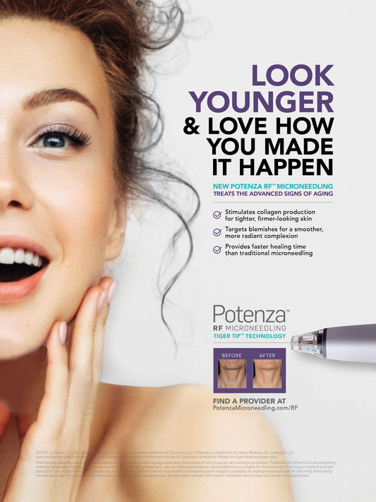 Cynosure Potenza RF – Neck Treatment – available at Beauty O’Clock Medical Spa in Aurora & Vaughan