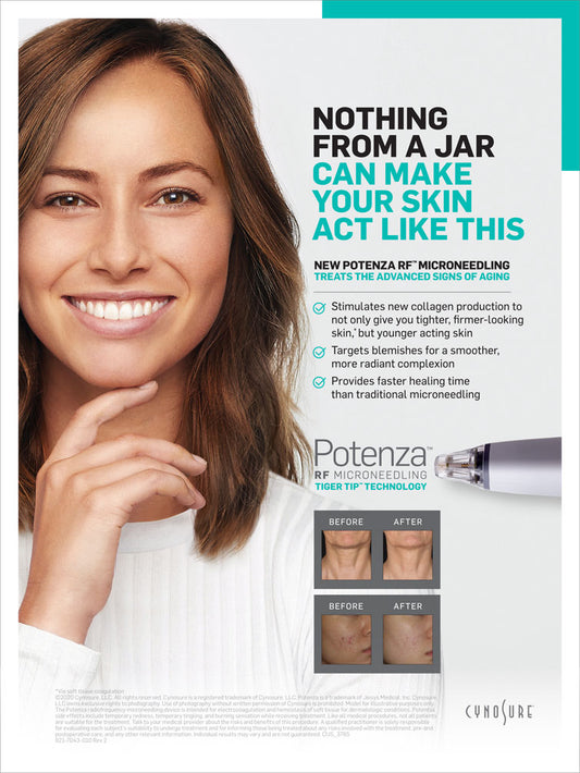 Cynosure Potenza RF – Face & Neck Treatment – available at Beauty O’Clock Medical Spa in Aurora & Vaughan