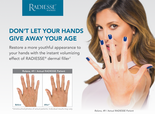 Radiesse® Hand Rejuvenation
