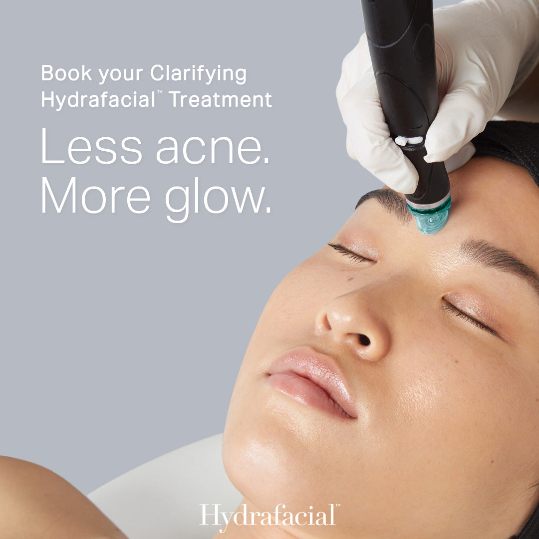 HydraFacial® for Acne-Prone Skin – available at Beauty O’Clock Medical Spa in Aurora & Vaughan