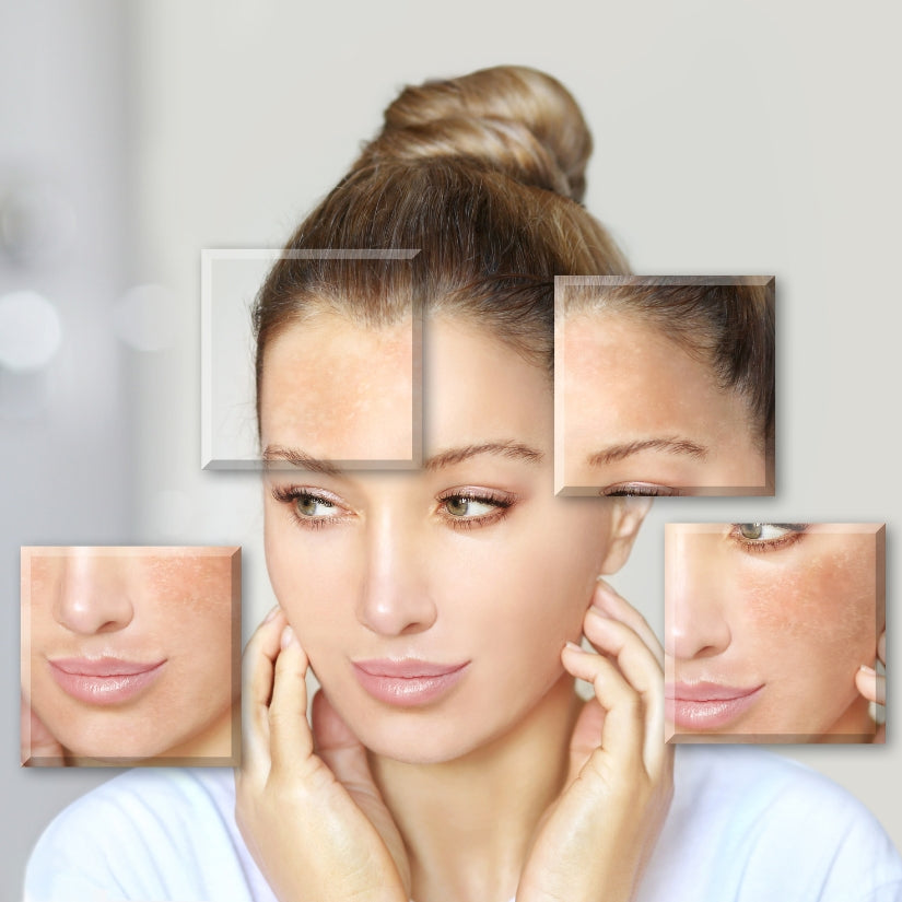 30 minute Professional Skin Care Consultation