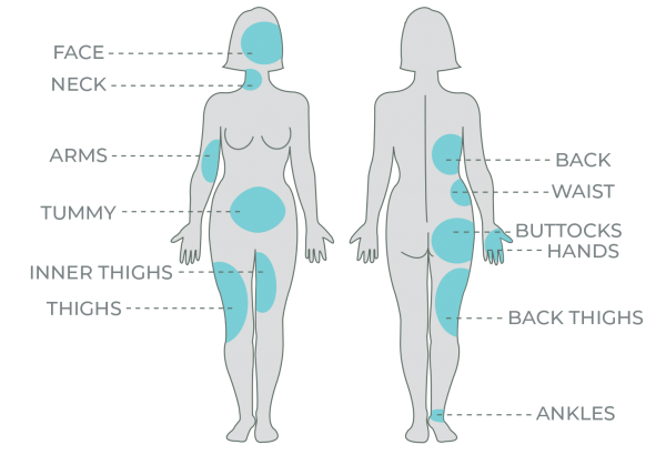 Hands Body Contouring – Pack of 6 Sessions