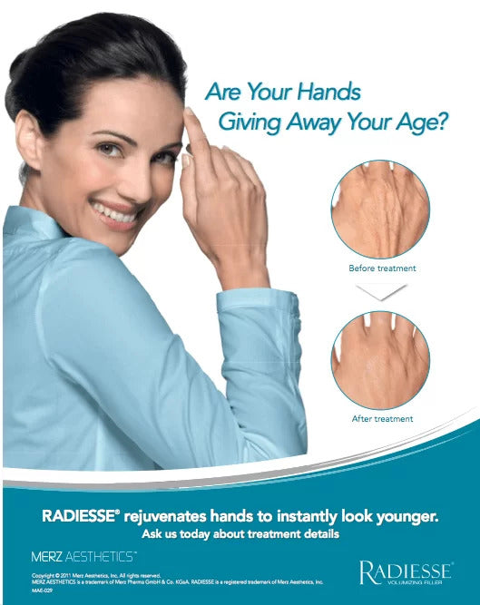 Radiesse® Hand Rejuvenation – available at Beauty O’Clock Medical Spa in Aurora & Vaughan