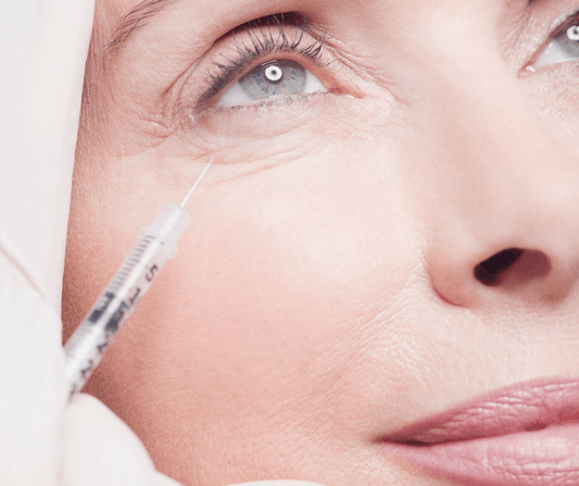 PRF - Under Eye Rejuvenation – available at Beauty O’Clock Medical Spa in Aurora & Vaughan