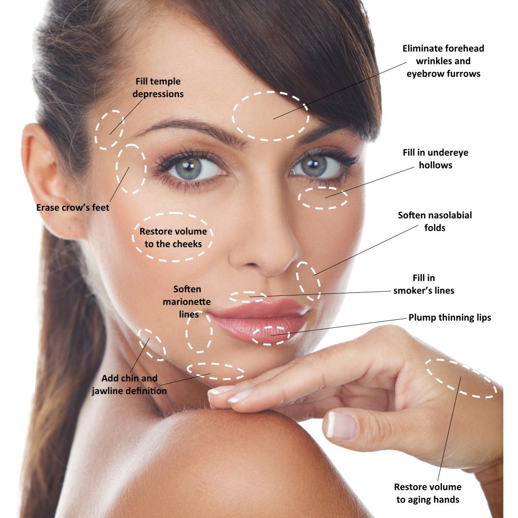 Scultptra Facial volume Restoration