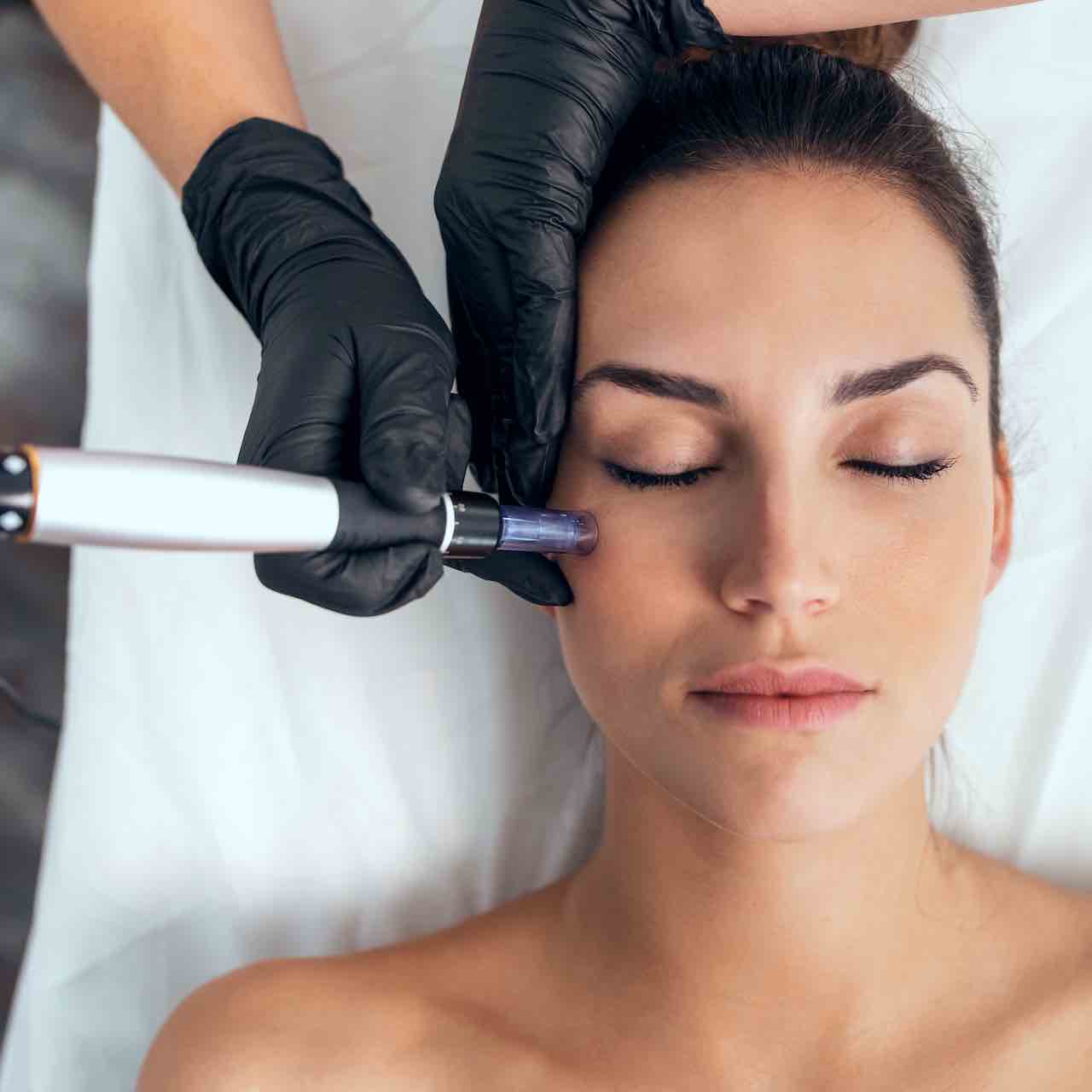 Microneedling with Mesotherapy