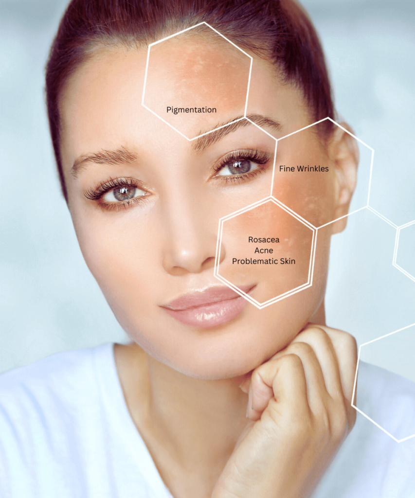 Skin Care Consultations