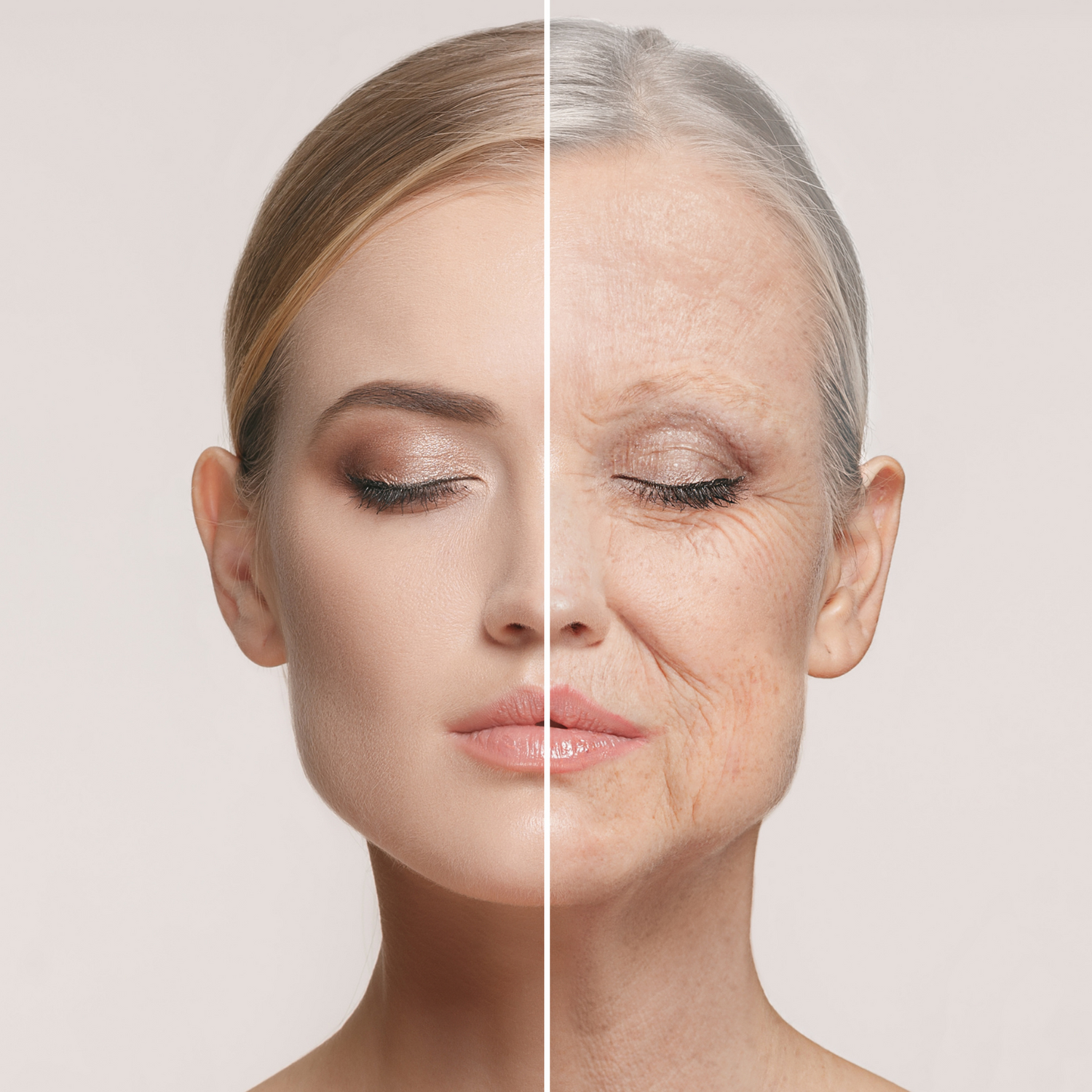 Morpheus8 wrinkles reduction in Aurora Newmarket Richmond Hill