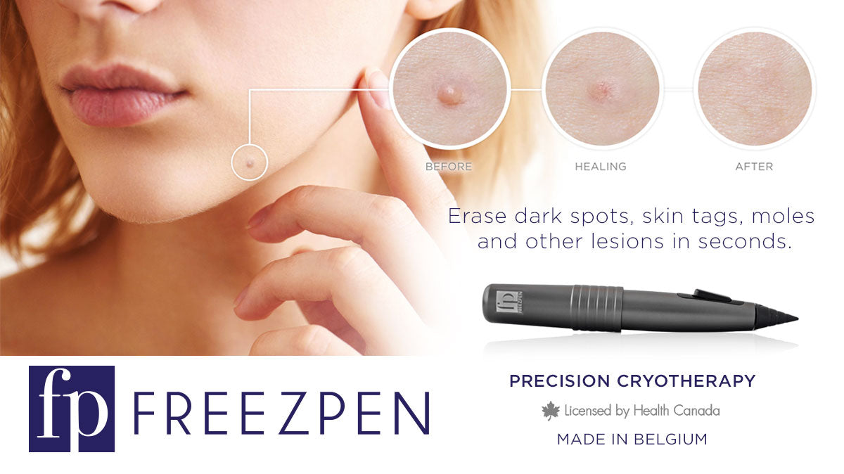 Load video: FreezPen &amp; CryoProbe XP - Beauty O&#39;Clock Medical Spa