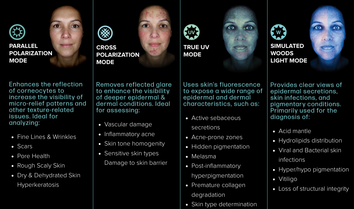 Skin Analysis Table Observ 520x 3D Skin Analysis – Beauty O’Clock Medical Spa