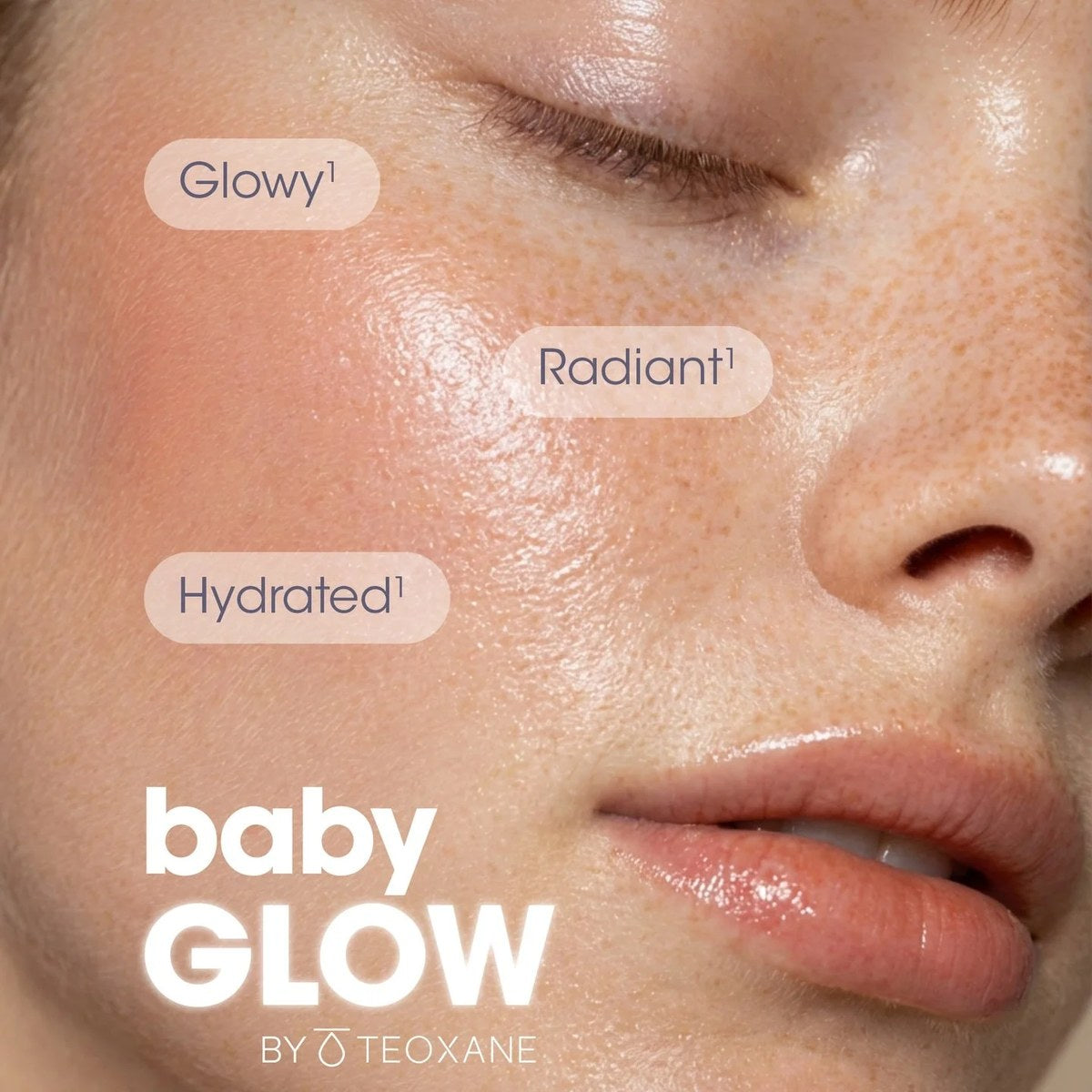 BabyGLOW by Teoxane — Skin Booster Injections