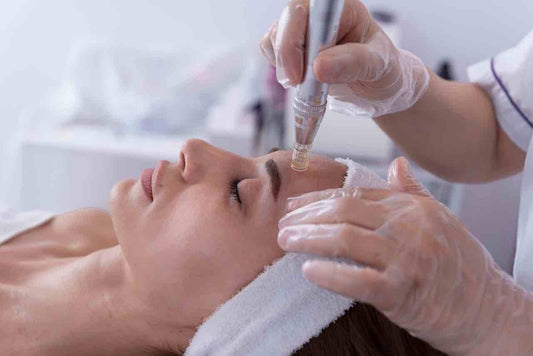 Microneedling + Mesotherapy for Face or Neck - pack of 3