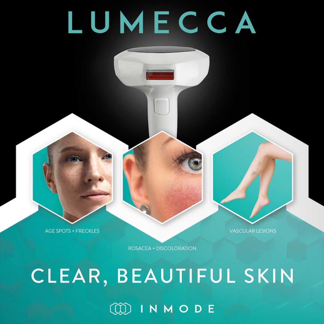 Shoulders (Lumecca IPL)