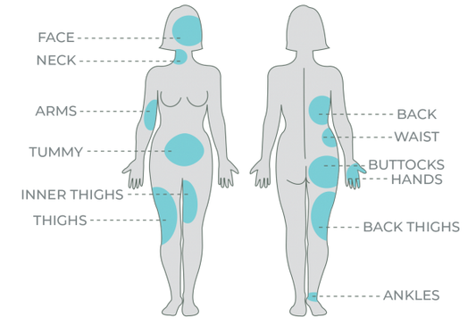 Arms Body Contouring