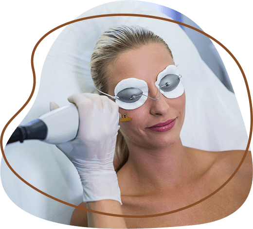 Clarity II Laser Under Eye Lightening