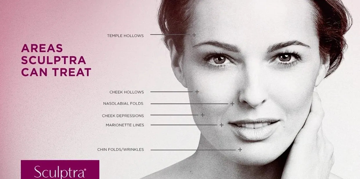 Sculptra Facial Volume Restoration